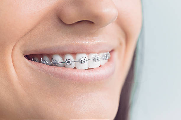 Best Wisdom Tooth Removal  in Fairview Ferndale, PA